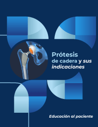 Prótesis de cadera y sus indicaciones. Educación al paciente.