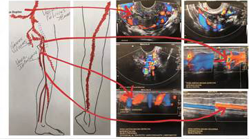 Rese�a Venous Symposium 2020 Latam, 2020